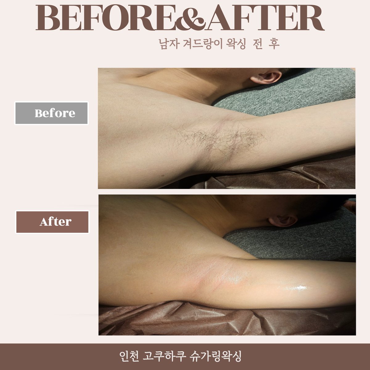 브라질리언왁싱전문 인천 고쿠하쿠슈가링 왁싱 (@kingdom8855) / Posts / X