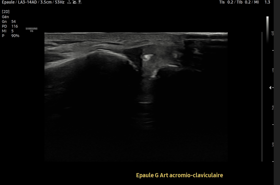 No SuperDoc tweet media