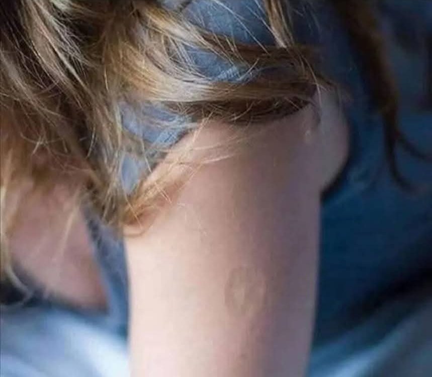 Ci sono persone, quasi sempre attempate, che girano con questo strano tatuaggio sul braccio.