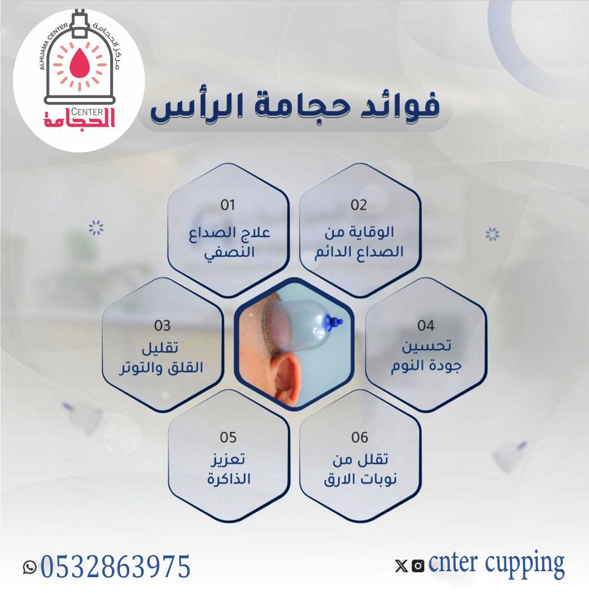 #عفيف_الحجامه_ضريه_الدوادمى_القصيم_عفيف