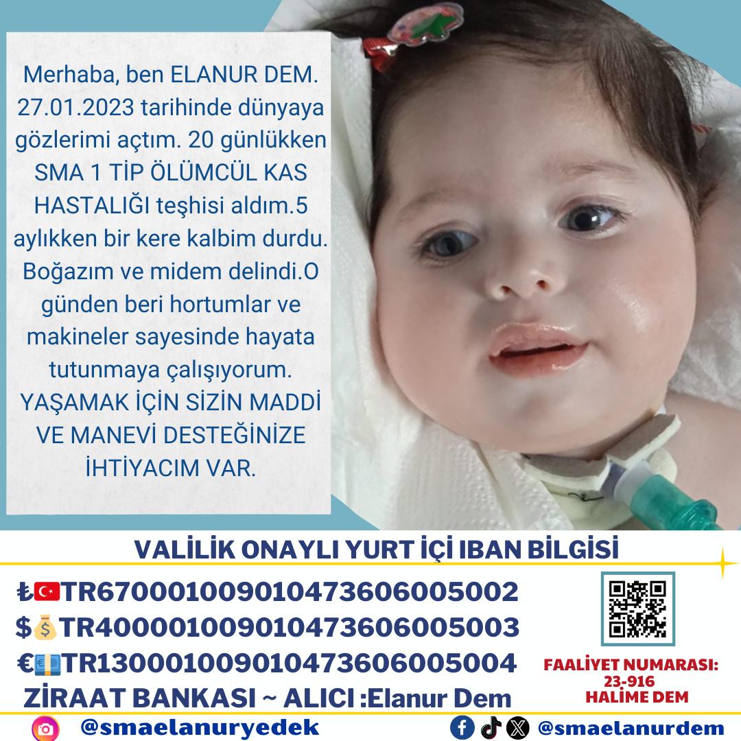 EteMizgin's tweet photo. @smaelanurdem El birliği ile Elanur bebeğimizi kurtaralım 🤲🏻
#LEGEND / Allahu Ekber / #HerkesDuysun / #perşembe / #Hamas / #Gazze / #İyilikSakada / #ZahideYetişTutuklansın / #AcunMedyaBoykot / Romulo / göksu / Menzil / İsrail / Yılmaz Özdil / #SONDAKİKA https://t.co/O07sOAaUwo