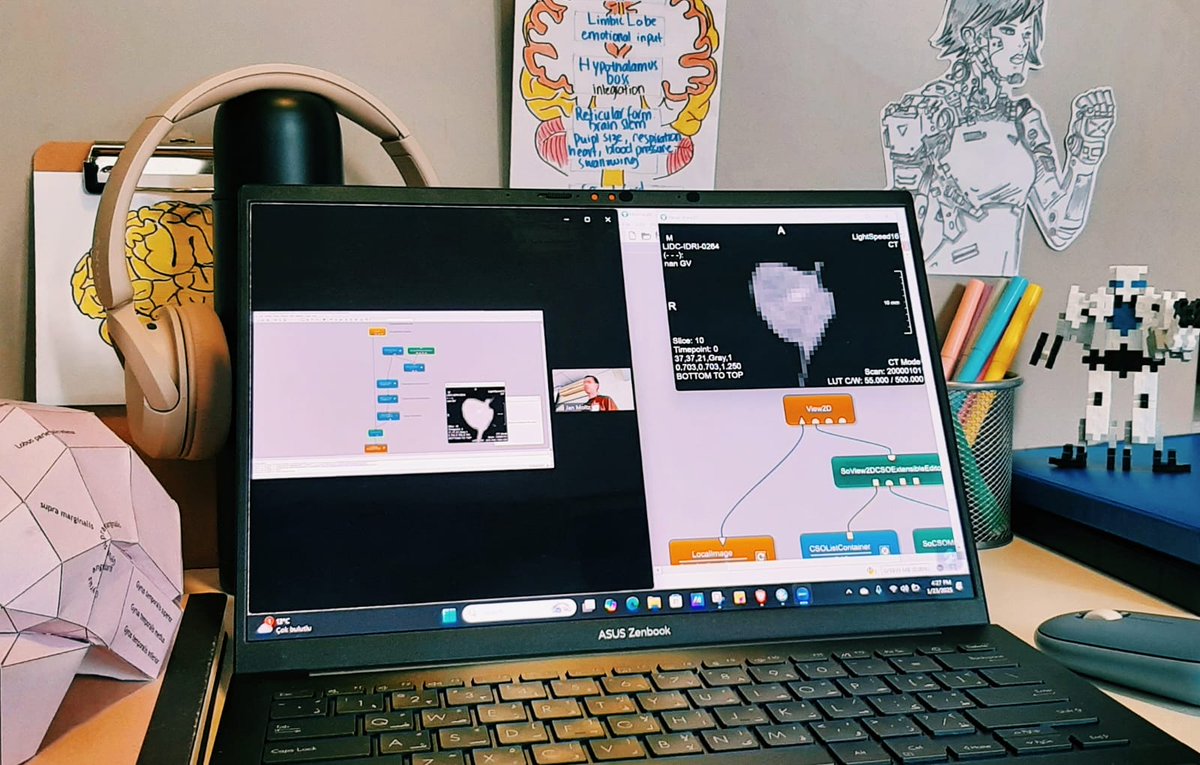Lina Alqam (@linaalqam) on Twitter photo Just wrapped up medical image segmentation session <a href="/TACTIX_Twinning/">TACTIX HORIZON Europe Twinning Project</a> Winter Workshop 2025 using MeVisLab. So much learned, and a big thanks to Dr. Jan Moltz for hands-on guidance!
#TACTIX2025 #LungLesion Just wrapped up medical image segmentation session <a href="/TACTIX_Twinning/">TACTIX HORIZON Europe Twinning Project</a> Winter Workshop 2025 using MeVisLab. So much learned, and a big thanks to Dr. Jan Moltz for hands-on guidance!
#TACTIX2025 #LungLesion
