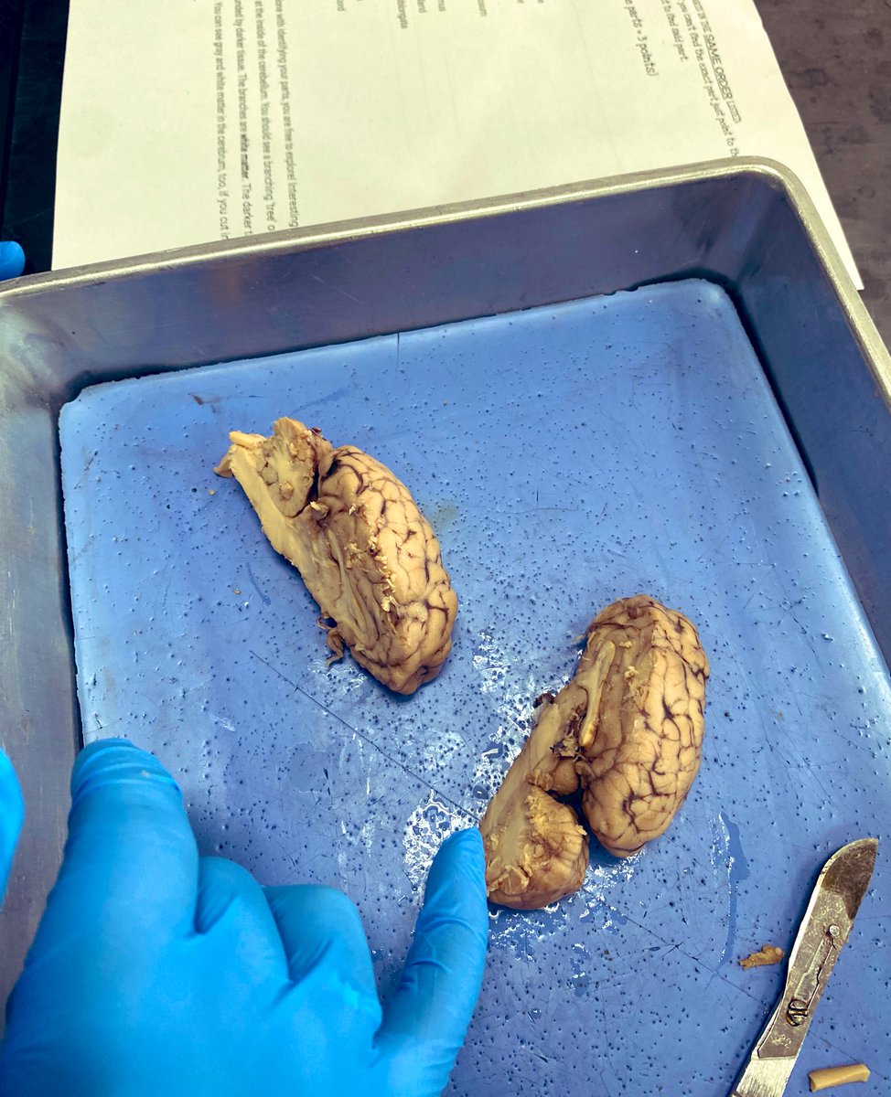 MrsAshlockCHS's tweet photo. Brain Dissection Day in anatomy! 🧠 @CHS_Indians #room205 https://t.co/t3bL65LhBR