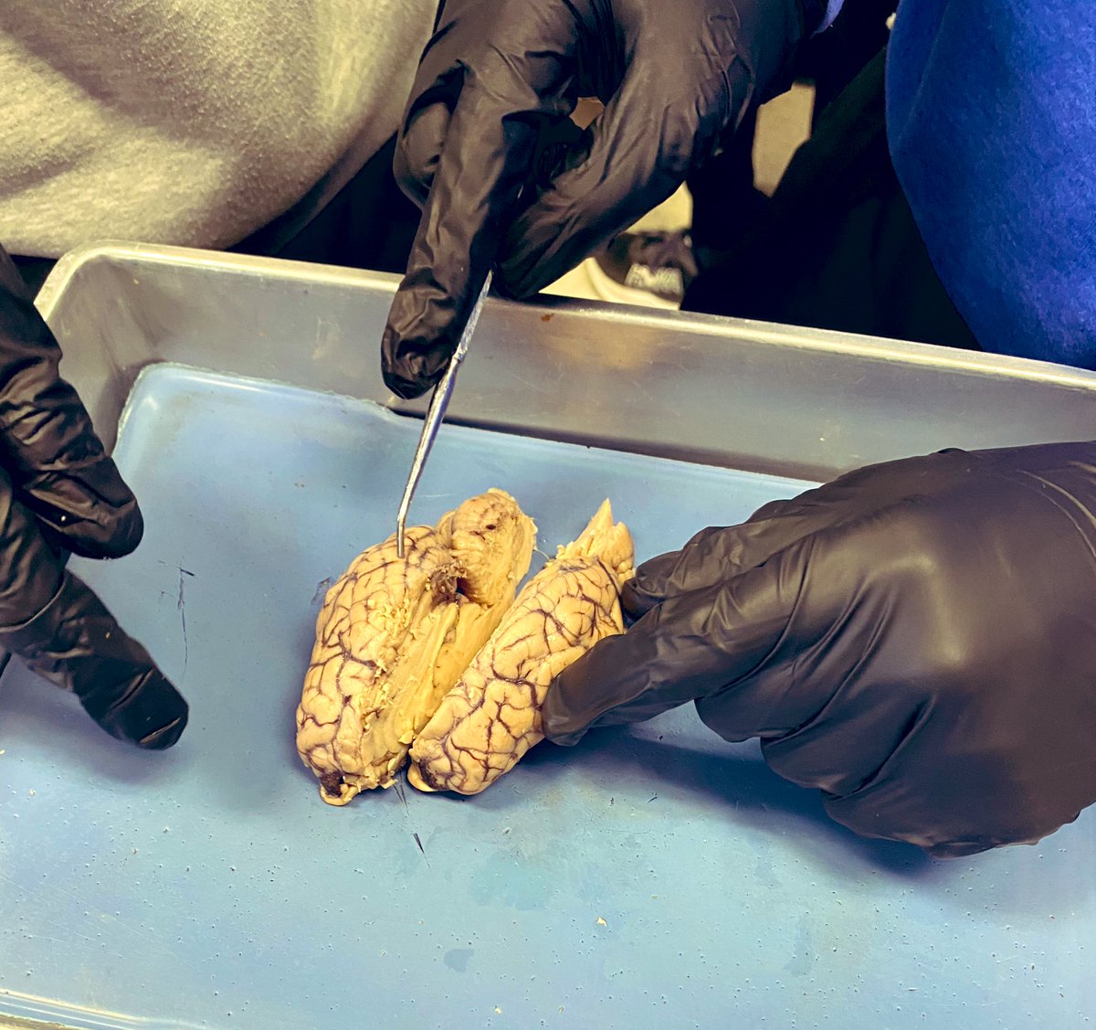 MrsAshlockCHS's tweet photo. Brain Dissection Day in anatomy! 🧠 @CHS_Indians #room205 https://t.co/t3bL65LhBR