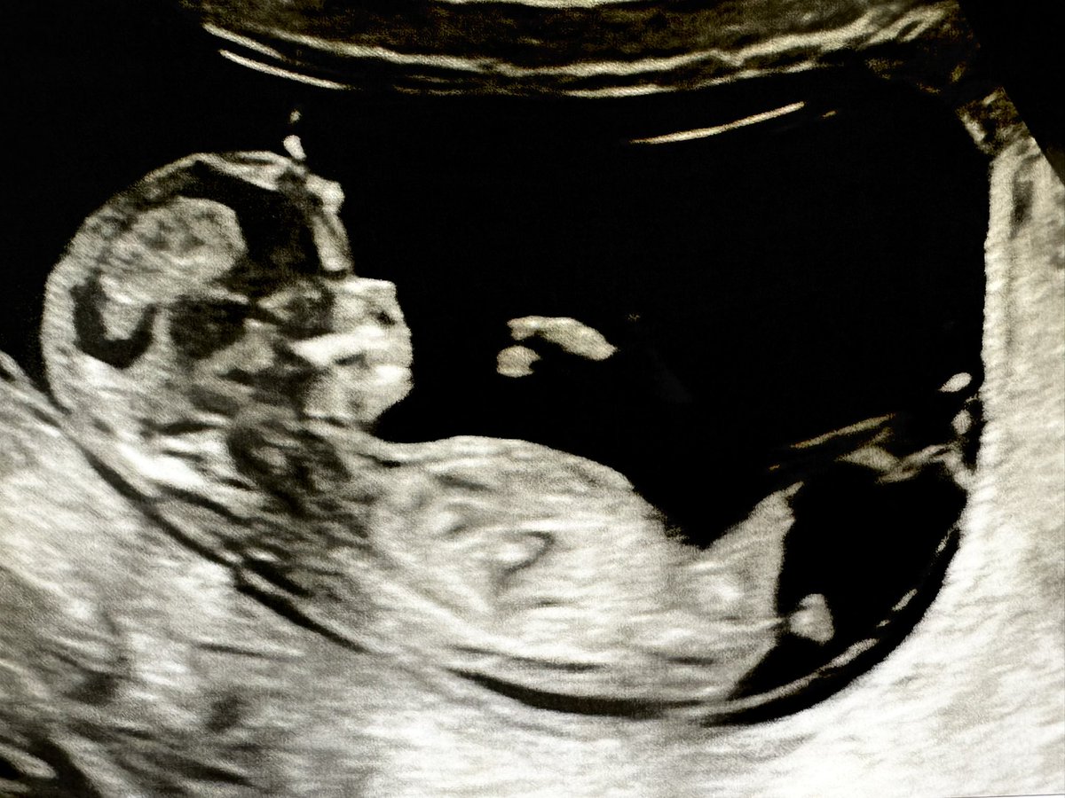 Pues me congratula anunciar que tenemos nuevo DLC en el horno.

Fecha aproximada de salida: Julio 2025

🎉🎉🎉🎉🎉

P.D: Tengo felicidad y miedo a partes iguales 🙈