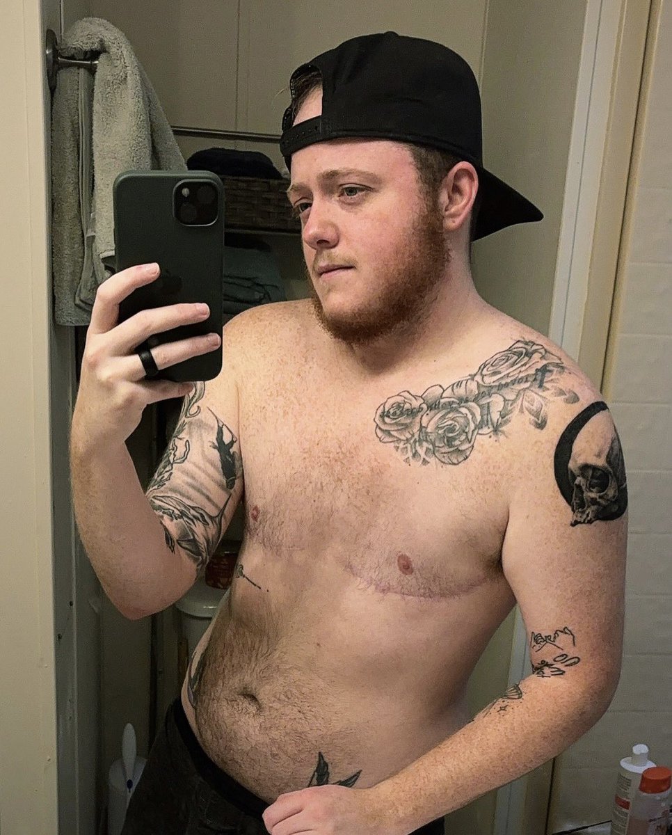 KaidenNathaniel's tweet photo. Gender affirming care saved my life.🏳️‍⚧️
#LGBTQ #transgender #transman #transmen #follow #transgenderftm https://t.co/LU3ElXLI7l