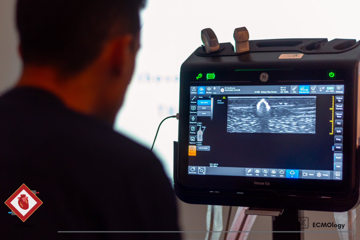 The first practical session was conducted by Dr. Abdulaziz Al-Sharydah. Participants engaged in Ultrasound-Guided Vascular Access, acquiring essential skills for E-CPR success!

#ECPR #CodeToCircuit