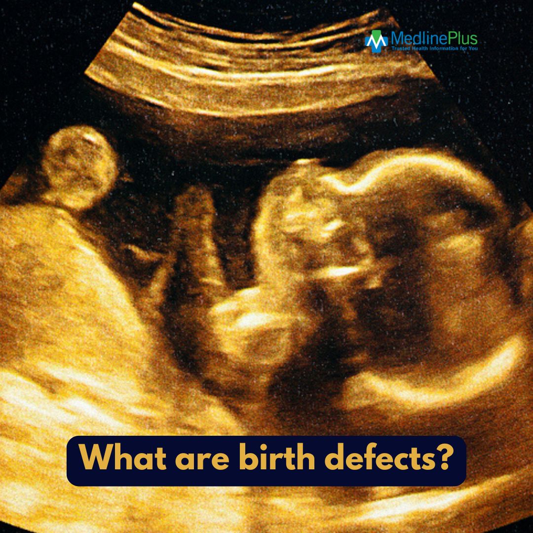 medlineplus's tweet photo. A birth defect is a problem that happens while a baby is developing in the mother's body. Most of them happen during the first 3 months of pregnancy. They can range from mild to severe. Can they be prevented? Learn more: https://t.co/UKH5YBW1Q7 #BirthDefectsPreventionMonth https://t.co/xefYsOz9TC