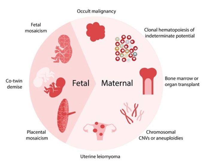 Clinical Chemistry (@clin_chem_adlm) on Twitter photo 🔥 Mini-Review: "Incidental Detection of Maternal #Cancer Following Cell-Free DNA Screening for Fetal Aneuploidies"
by Ian S Goldlust & <a href="/DianaBianchiMD/">Diana Bianchi</a>
<a href="/NICHD_NIH/">NICHD News</a>
#MedTwitter #PathTwitter #LabMedX
👉 buff.ly/3WksSpA 🔥 Mini-Review: "Incidental Detection of Maternal #Cancer Following Cell-Free DNA Screening for Fetal Aneuploidies"
by Ian S Goldlust & <a href="/DianaBianchiMD/">Diana Bianchi</a>
<a href="/NICHD_NIH/">NICHD News</a>
#MedTwitter #PathTwitter #LabMedX
👉 buff.ly/3WksSpA