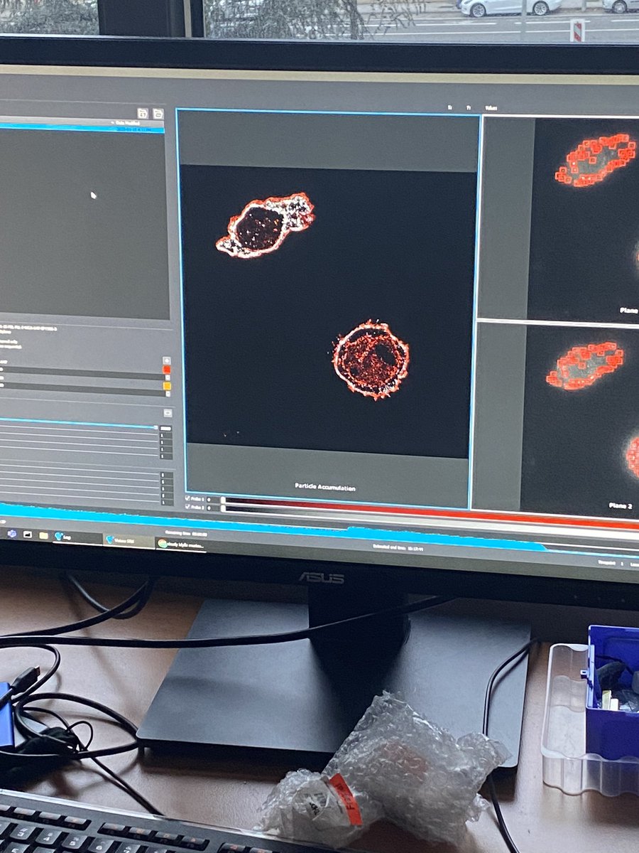 Karine MONIER (@kmonier007) on Twitter photo New Multicolor dSTORM images on lymphocytes for the WS on the #VXL <a href="/BrukerFM/">Bruker Fluorescence Microscopy</a> with <a href="/DMuriaux/">Delphine Muriaux</a> in Lyon <a href="/iNeuroMyoGene/">InstitutNeuroMyoGène</a> thanks to <a href="/CNRS/">CNRS 🌍</a> using #Evwrapark2.0 <a href="/IdylleLabs/">Idylle</a> New Multicolor dSTORM images on lymphocytes for the WS on the #VXL <a href="/BrukerFM/">Bruker Fluorescence Microscopy</a> with <a href="/DMuriaux/">Delphine Muriaux</a> in Lyon <a href="/iNeuroMyoGene/">InstitutNeuroMyoGène</a> thanks to <a href="/CNRS/">CNRS 🌍</a> using #Evwrapark2.0 <a href="/IdylleLabs/">Idylle</a>