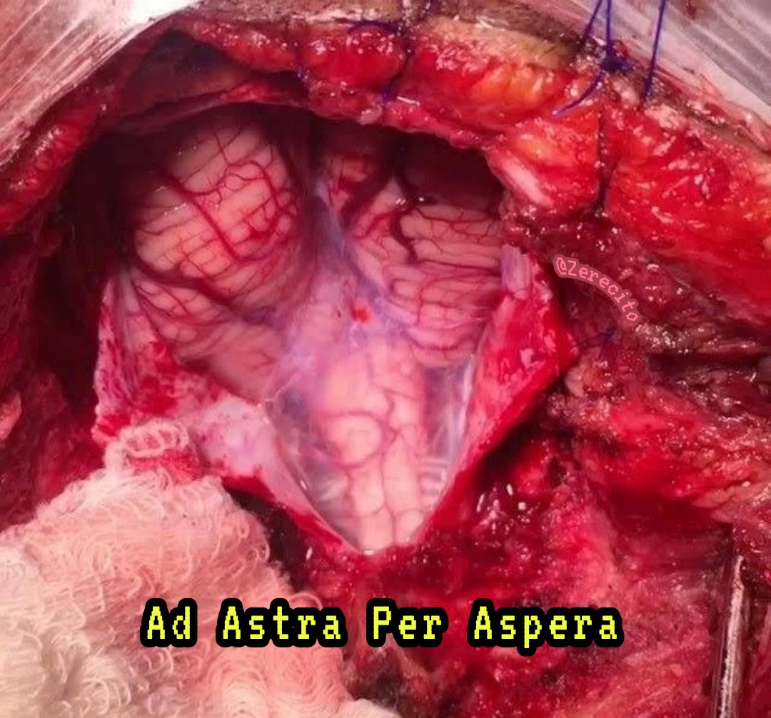 ✨❤️‍🔥𝖅a҉𝖗𝖙𝖑𝖎𝖈𝖍𝖊𝖀𝖓𝖇𝖊𝖖𝖚𝖊𝖒𝖊 ❤️‍🔥✨ tweet media