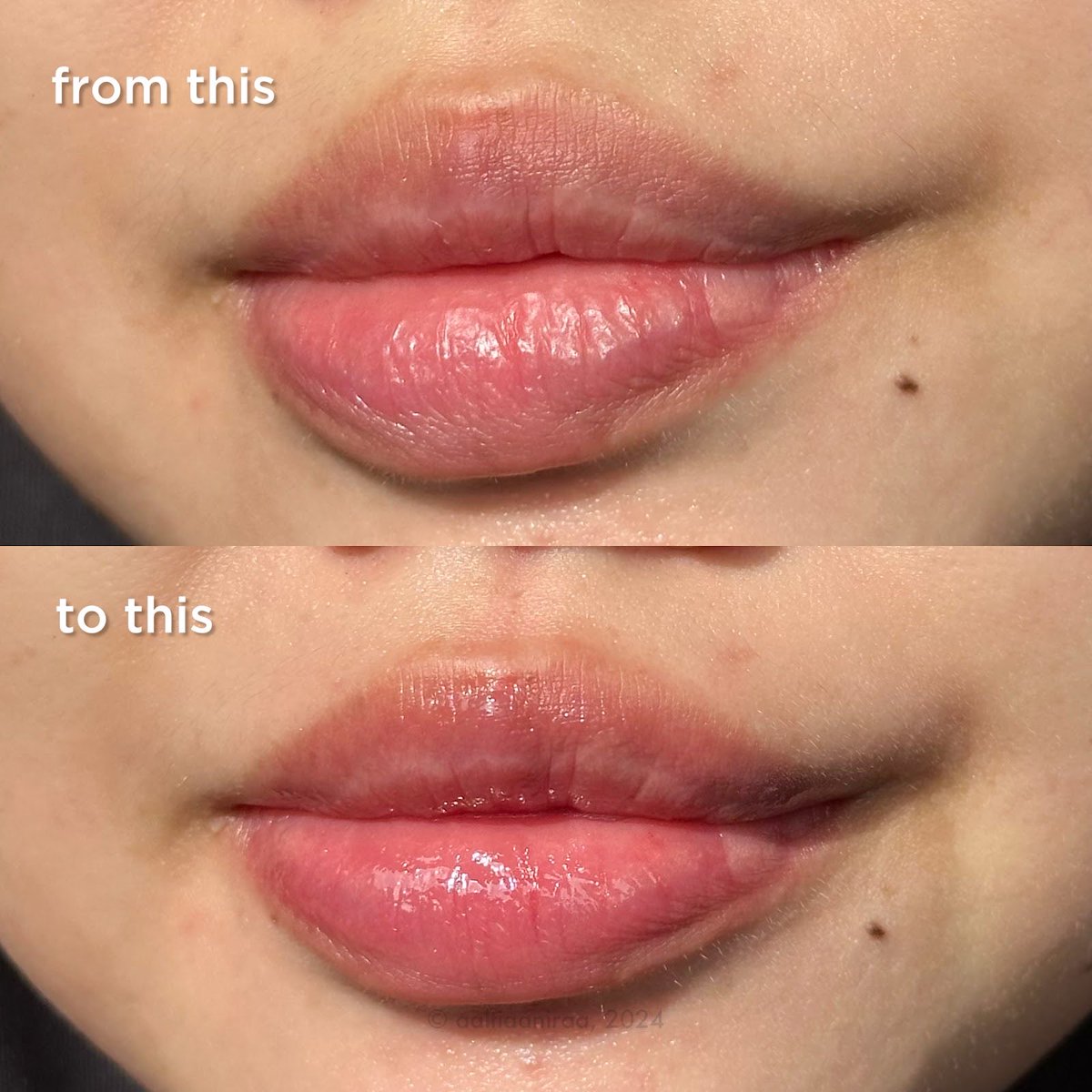 bakuchiollyc's tweet photo. SINI AKU REKOMENDASIIN SI KECIL CABE RAWIT YANG BIKIN BIBIR JADI SUPER CAKEPP

Ini lipcare bisa bantu cerahin, lembapin, plus menutrisi bibir jd secakep ini🥹🫶🏻 https://t.co/UrltvK5wrJ