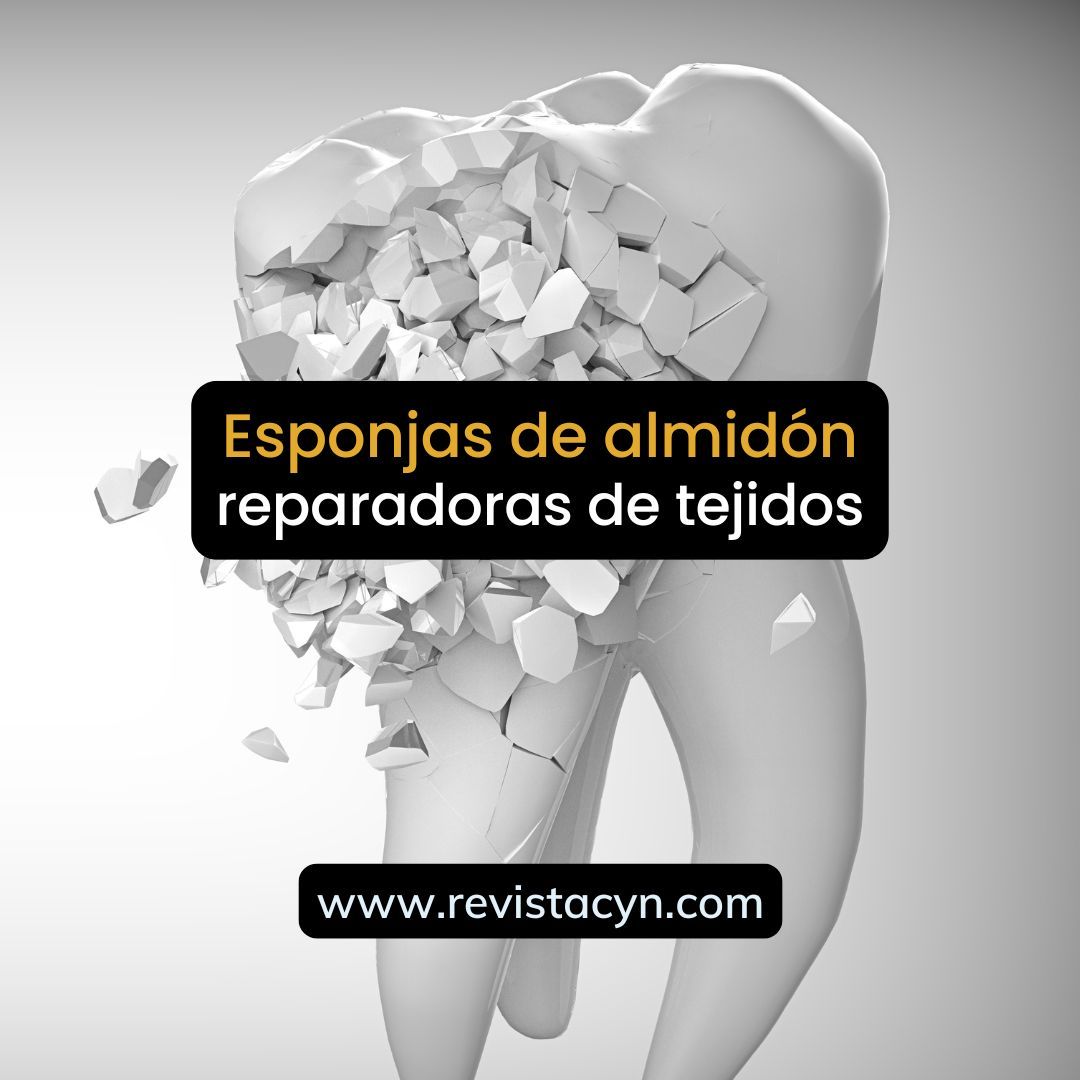 Revista_CyN's tweet photo. 🦷✨ En la odontología, las esponjas de almidón son innovadoras y prometedoras, ayudando a la regeneración de tejidos para recuperar las sonrisas 😁🌟 
🔍 Revista 🚀 Ciencia y Naturaleza 🍀
 #RevistaCyN #Divulgación #Difusión #Leer+
👉 https://t.co/9gkoLSa0OJ https://t.co/4b1u912Obn