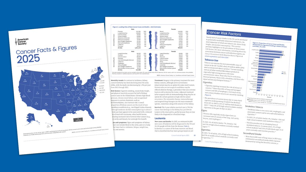 ACSNews (@acsnews) on Twitter photo <a href="/AmericanCancer/">American Cancer Society</a> Annual Cancer Statistics Report 2025 out today in <a href="/CACancerJournal/">CA: A Cancer Journal for Clinicians</a>: Cancer Mortality Continues to Drop Despite Rising Incidence in Women; Rates of New Diagnoses Under 65 Higher in Women Than Men. Led by <a href="/ACS_Research/">ACS Research</a> <a href="/rlsiegel25/">Rebecca Siegel</a> Read here: pressroom.cancer.org/2025CancerFact… <a href="/AmericanCancer/">American Cancer Society</a> Annual Cancer Statistics Report 2025 out today in <a href="/CACancerJournal/">CA: A Cancer Journal for Clinicians</a>: Cancer Mortality Continues to Drop Despite Rising Incidence in Women; Rates of New Diagnoses Under 65 Higher in Women Than Men. Led by <a href="/ACS_Research/">ACS Research</a> <a href="/rlsiegel25/">Rebecca Siegel</a> Read here: pressroom.cancer.org/2025CancerFact…