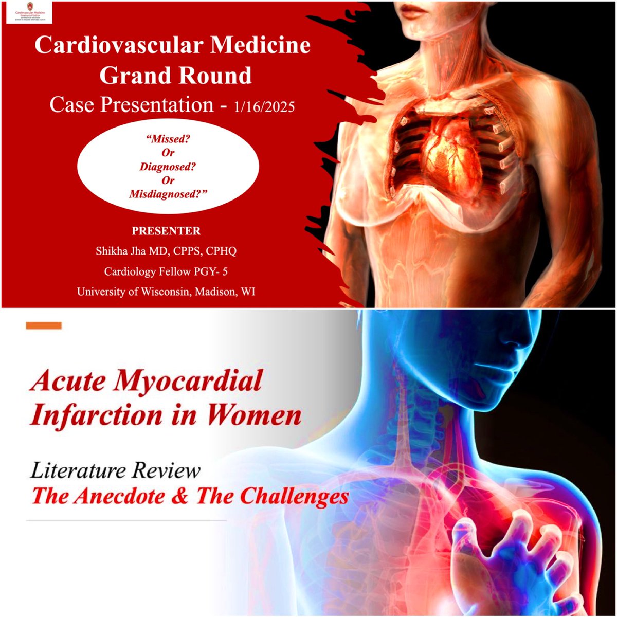 Shikha_Cardio's tweet photo. What an exciting day it was - as I presented Case driven literature review on “Acute Myocardial Infarction in Women” at @uw_cvm Grand Rounds this morning.🫀❤️ #WIC #FellowInTraining #LoveForHeart #WomenAndAMI https://t.co/BUHTkLShbB
