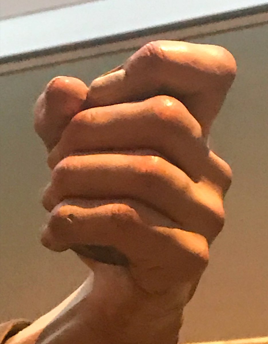 Raymond_Kinman's tweet photo. We saw this astonishing carved wood statue of St. Gines de la Jara at the Getty Museum, and it completely took my breath away.  The details were so stunning, so lifelike….the museum information plaque didn’t include many details, so I wanted to know more about the artist who created this incredible carving.  

As it turns out, this statue was carved in 1692 by….

Wait for it….

A woman?

It’s true.  This incredible piece was carved by Luisa Roldán, or La Roldana, a 17th-century Spanish sculptor who broke barriers as the first female court sculptor for the kings of Spain.  In the 17th century, women weren’t accepted as professional artists because society expected them to stick to domestic roles like running a household and raising children. 

Training opportunities were scarce; women were often barred from workshops, guilds, and art academies, and they couldn’t study crucial subjects like anatomy, because it was considered “inappropriate” for a woman. 

Sculpture, in particular, was considered too physical for women, and most patrons preferred commissioning men, assuming women lacked the skill and/or professionalism. 

La Roldana defied all of that. She learned carving in her father’s workshop, honed her craft, and ultimately became the first female court sculptor to the kings of Spain.

Despite her obvious genius, Roldán lived much of her life in poverty, even as the court sculptor.  She struggled financially despite her immense talent.  This was partly because, even at the highest levels, artists of her time were often underpaid or faced delays in receiving payment for commissions. Additionally, as a woman, she faced extra hurdles in gaining consistent and lucrative work, as patrons consistently favored  male artists.

Although she held a prestigious position, the court often failed to pay her regularly or adequately. Combined with the lack of a strong support system and her limited ability to advocate for herself in a male-dominated field, these factors left her in a state of near poverty throughout much of her life.

She was a master of polychrome sculpture, carving figures out of wood and bringing them to life with layers of intricate paintwork. Using a technique called encarnación, she created the illusion of translucent, living skin, even painting delicate blue veins beneath the surface. To heighten the realism, the statue also features glass eyes, which catch the light, making the figure feel almost alive.

What’s really striking is her use of exaggeration. Hands and feet are really difficult to carve.  The slightly oversized hands and feet of St. Gines amplify the emotional intensity and presence of this piece, right down to the tiniest details such as the toenail fungus.  Notice how the knuckles are a tiny bit larger than in real life.

It appears to me that at one time this dude may have been holding something in his left hand but I couldn’t find any information about that.
#BaroqueArt #Sculpture #ArtHistory #WomenInArt #GettyMuseum #LaRoldana #SpanishArt #WoodSculpture #PolychromeSculpture #FemaleArtists