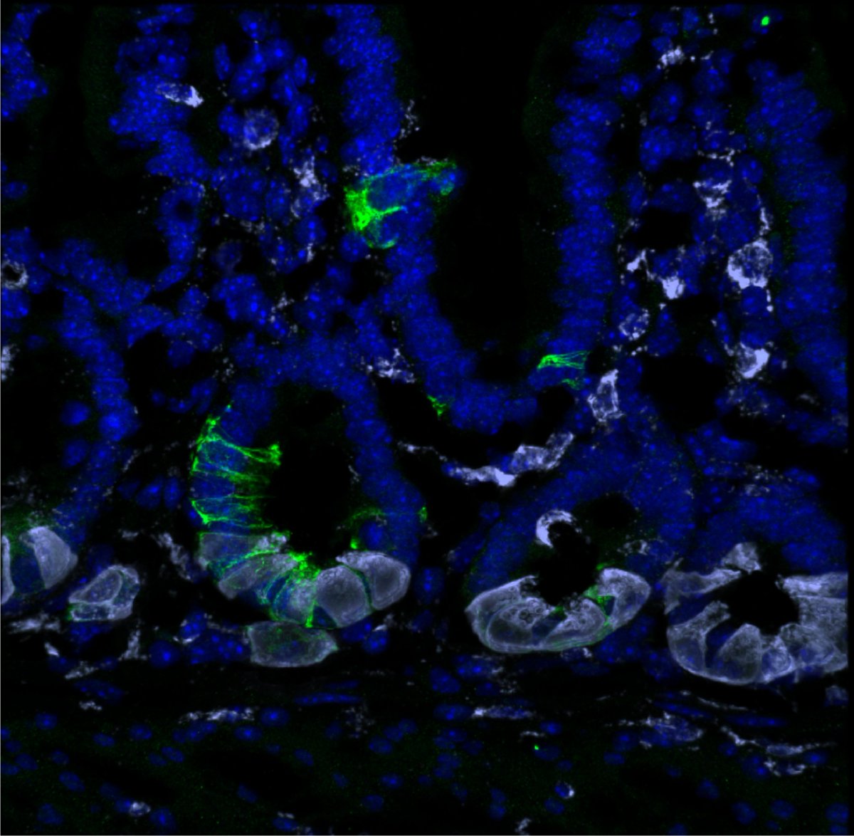 reNEW (@renew_global) on Twitter photo New discoveries on intestinal epithelium maintenance will change the way scientists think of tissue maintenance in the intestine.
Read the full story based on the work of <a href="/JensenLab_UCPH/">Kim Jensen Lab</a> 👇
shorturl.at/rkUFr New discoveries on intestinal epithelium maintenance will change the way scientists think of tissue maintenance in the intestine.
Read the full story based on the work of <a href="/JensenLab_UCPH/">Kim Jensen Lab</a> 👇
shorturl.at/rkUFr