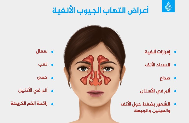 arabaltmed's tweet photo. 1.
التهاب الجيوب الأنفية | Sinusitis
انت ما بين البخاخات ومسكنات آلام الى المضادات الحيويه وحتى الجراحه.

✔️اين يكمن الخلل وما هي الطرف البديله المتاحه منزليا او من خلال علاجات الطب البديل.

✳️للي يبحث عن حل دائم بعيدا عن الحلول المؤقته إليكم هذا الثريد المهم
تابع وانشر تؤجر https://t.co/I4bQdh9frL