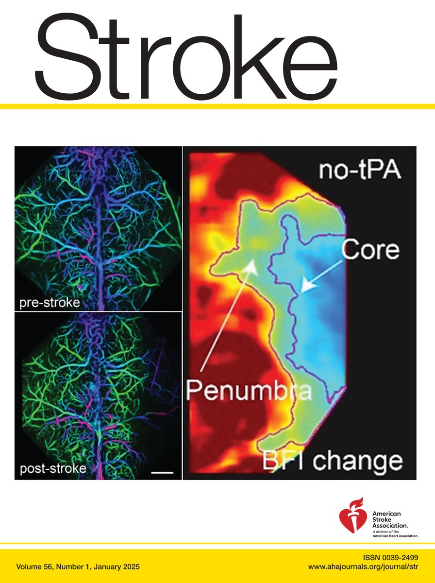 Stroke AHA/ASA (@strokeaha_asa) on Twitter photo đź§µ#STROKE Highlights for January are here:
🌟 #REGARDS study showed that duration of hypertension exposure is relevant in stroke prevention and supports efforts to delay hypertension onset. <a href="/MaryCushmanMD/">Mary Cushman 🫀🧠🩸</a> <a href="/brainstamm/">Brian Stamm, MD MSc</a> 🧵#STROKE Highlights for January are here:
🌟 #REGARDS study showed that duration of hypertension exposure is relevant in stroke prevention and supports efforts to delay hypertension onset. <a href="/MaryCushmanMD/">Mary Cushman 🫀🧠🩸</a> <a href="/brainstamm/">Brian Stamm, MD MSc</a>