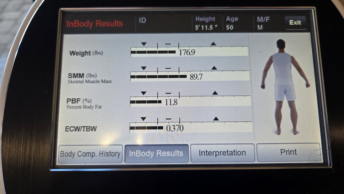 ngriffin360's tweet image. Carnivore Diet Progress: Day 1 vs. Day 15

Weight: 182.5 lbs → 176.9 lbs (-5.6 lbs overall)

Body Fat Percentage: 14.4% → 11.8% (-5.4 lbs of fat lost)

Skeletal Muscle Mass (SMM): 89.3 lbs → 89.7 lbs (+0.4 lbs muscle gained)

Age 50.

@SBakerMD
#carnivoremonth #carnivorediet