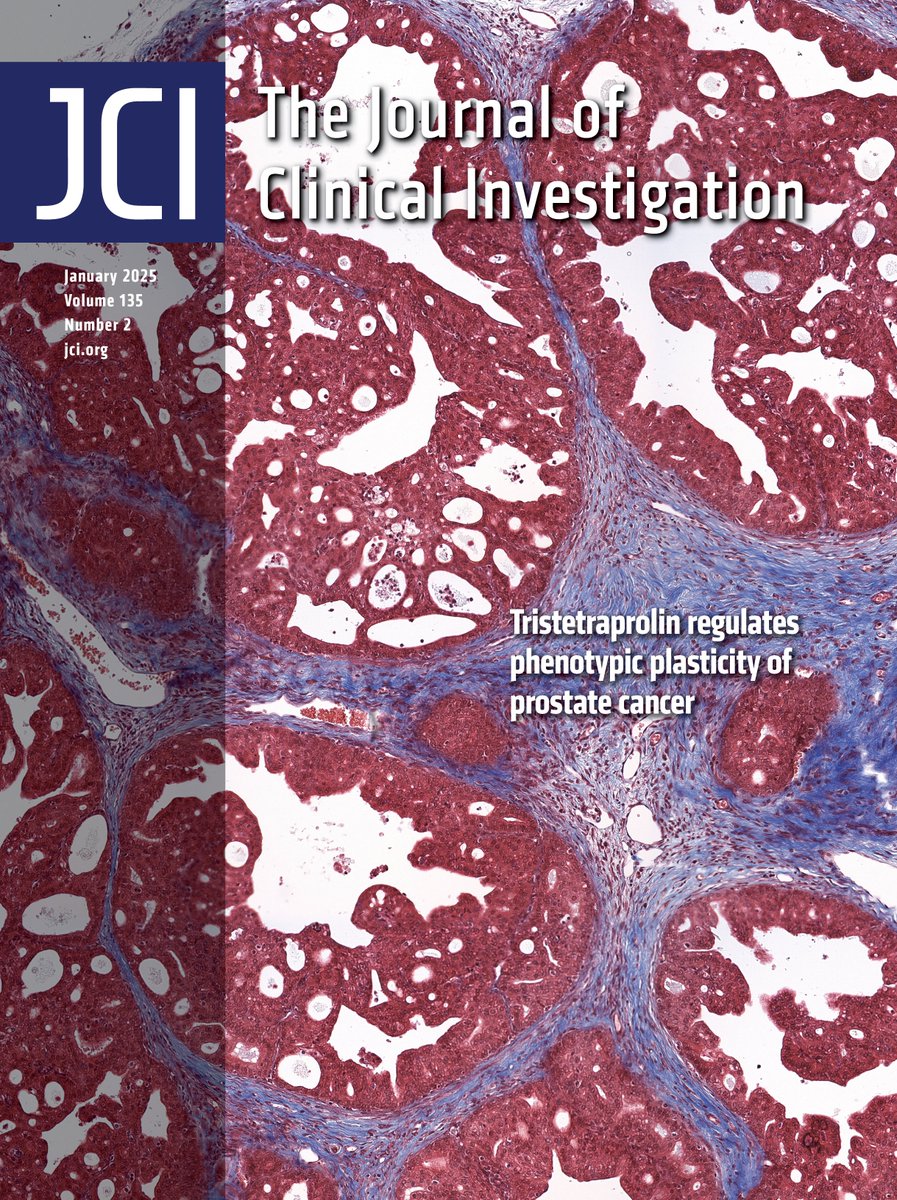 Journal of Clinical Investigation (@jclinicalinvest) on Twitter photo The mechanism underlying the progression of castration-resistant prostate cancer!
This month’s cover features work by <a href="/kat_morel/">Katherine Morel</a> <a href="/BeatrizGerFalc/">Beatriz</a> <a href="/ChrisSweens1/">Christopher Sweeney, MBBS</a> <a href="/EllisLab/">ExpressionEngine</a> & team showing Tristetraprolin regulates phenotypic plasticity of prostate cancer: jci.org/articles/view/… The mechanism underlying the progression of castration-resistant prostate cancer!
This month’s cover features work by <a href="/kat_morel/">Katherine Morel</a> <a href="/BeatrizGerFalc/">Beatriz</a> <a href="/ChrisSweens1/">Christopher Sweeney, MBBS</a> <a href="/EllisLab/">ExpressionEngine</a> & team showing Tristetraprolin regulates phenotypic plasticity of prostate cancer: jci.org/articles/view/…