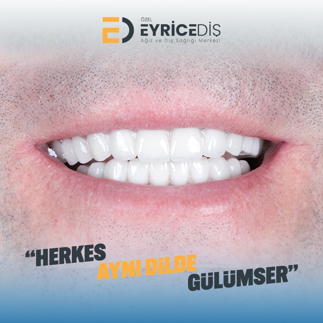 Daha Detaylı Bilgi Ve Randevu İçin;

📞 444 1 496
✉️ info@eyricedis.com.tr
🌐 eyricedis.com.tr
📍 Esentepe Mah. Kasap Sok. No:1 FSM Bul. Nilüfer/Bursa

#eyricediş #herkesaynıdildegülümser