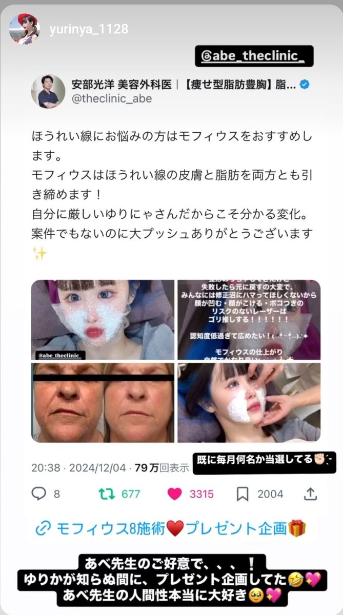 theclinic_abe's tweet photo. 第6回モフィウスプレゼント✨🎁✨
もちろん今週もやりますよ！
ゆりにゃさんお気に入りの「モフィウスほうれい線」を1名様に無料プレゼント！
ほうれい線の気になるたるみをしっかり引き締めます！
応募はアカウントフォローしてから、リポスト、いいねお願いします✨️
当選発表は21日正午です😎 https://t.co/mWnuJizG7X