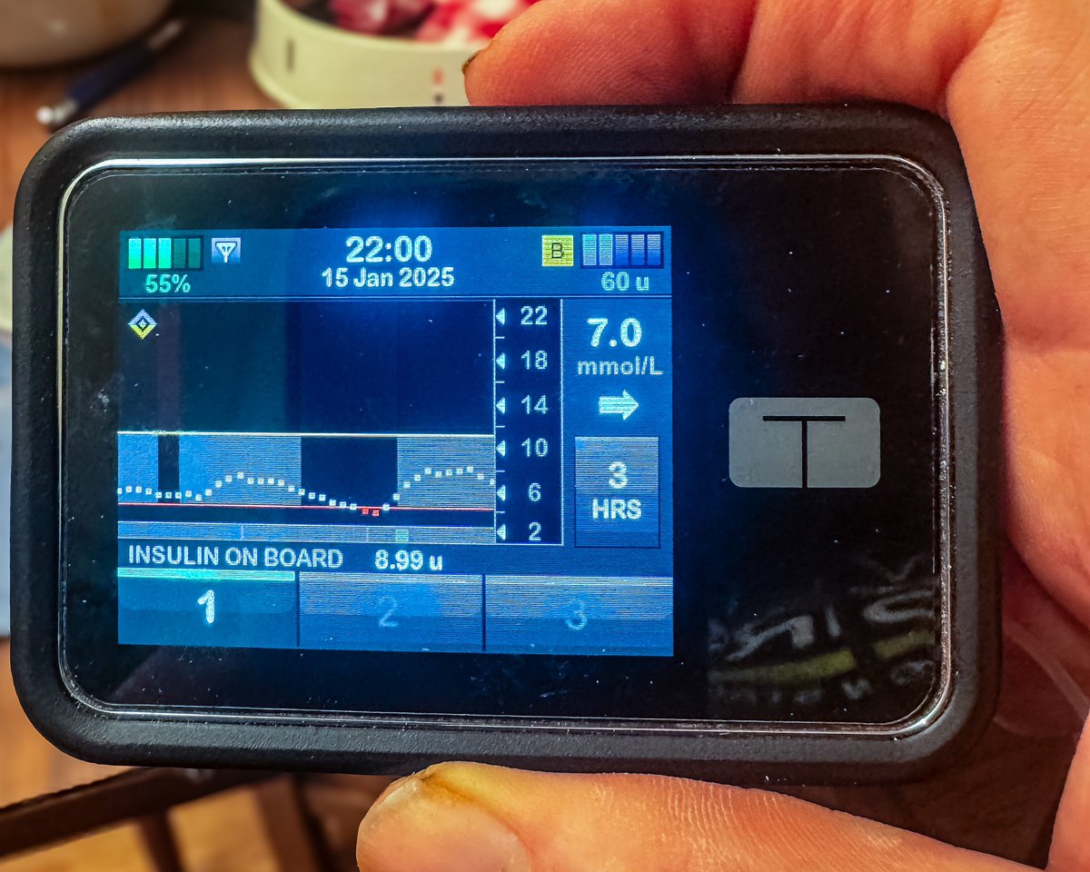 MarcLungley's tweet image. Ok, so I've just checked and having used #ControlIQ with my #TSlimX2 for about 24 hours for those hours I have a time in range of 97% and a time in tight range of 83%. I don't have to pre-bolus so much as well. Time in happiness off the charts #GBDoc #DiabetesChat #T1D #dedoc