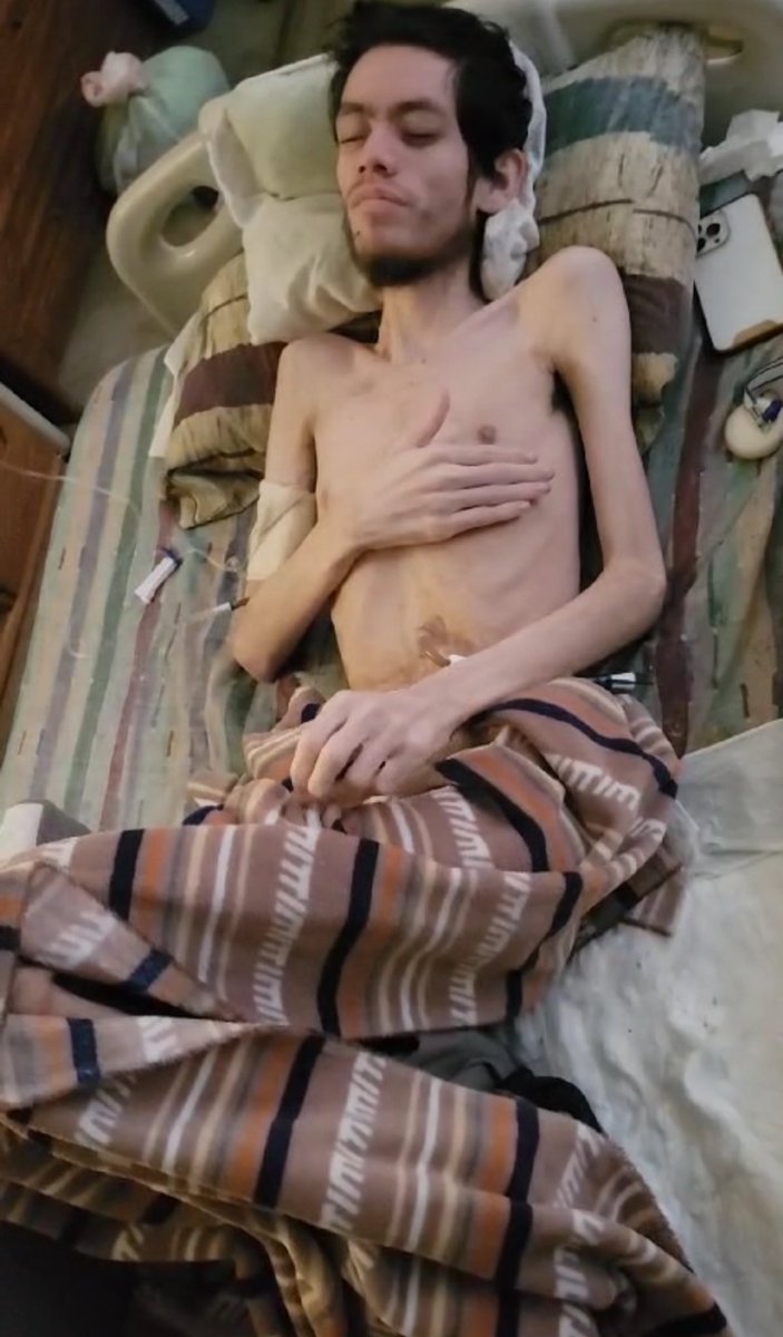 Stefan Arce ME/CFS tweet media