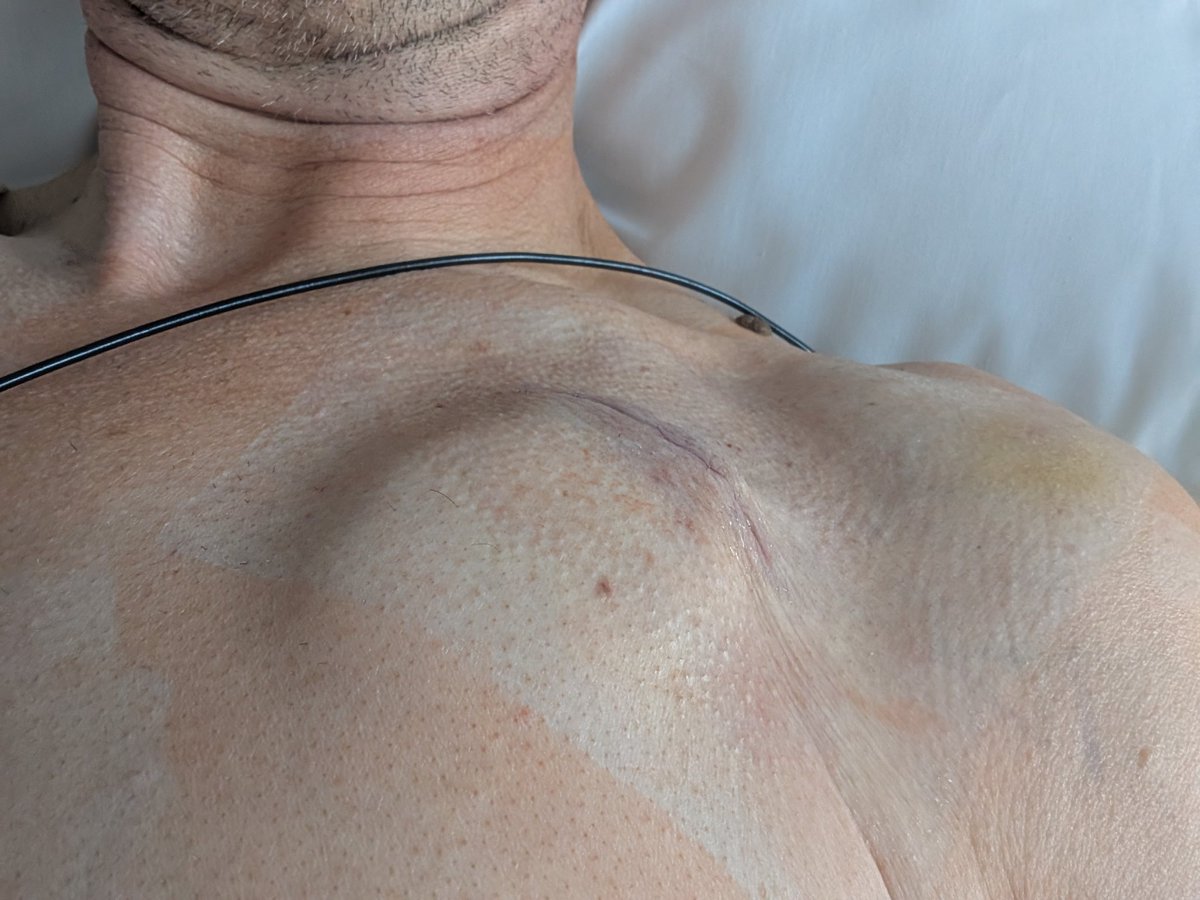 Matt Griffin tweet media