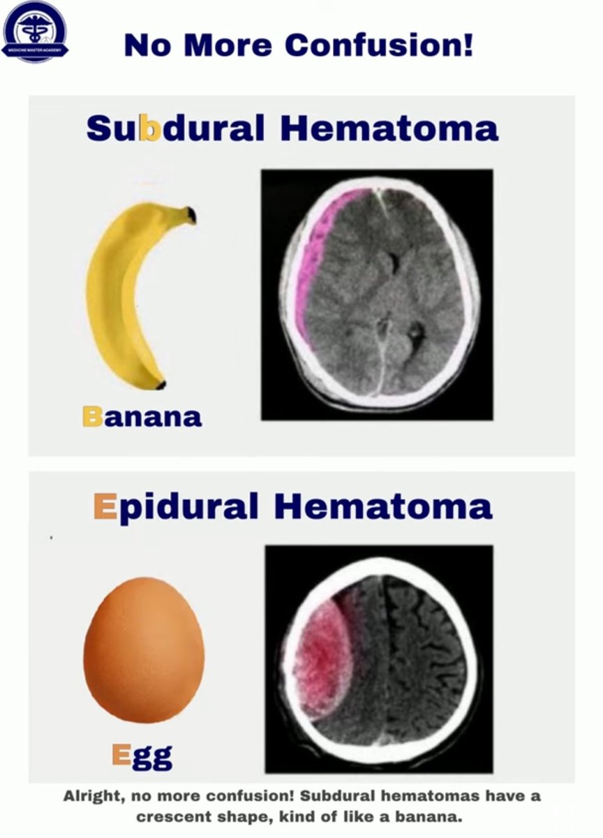 OGdukeneurosurg's tweet photo. Name differences between these two brain bleeds? https://t.co/cDRpwWhl99