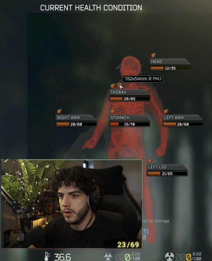 karyfars's tweet photo. @Kruscle @tanjiroo7x @mrgibb0n he is just rage baiting. thats his treatment screen after that video clip ends
VOD timestamp 02:58:30 from today. https://t.co/0vwDCERost