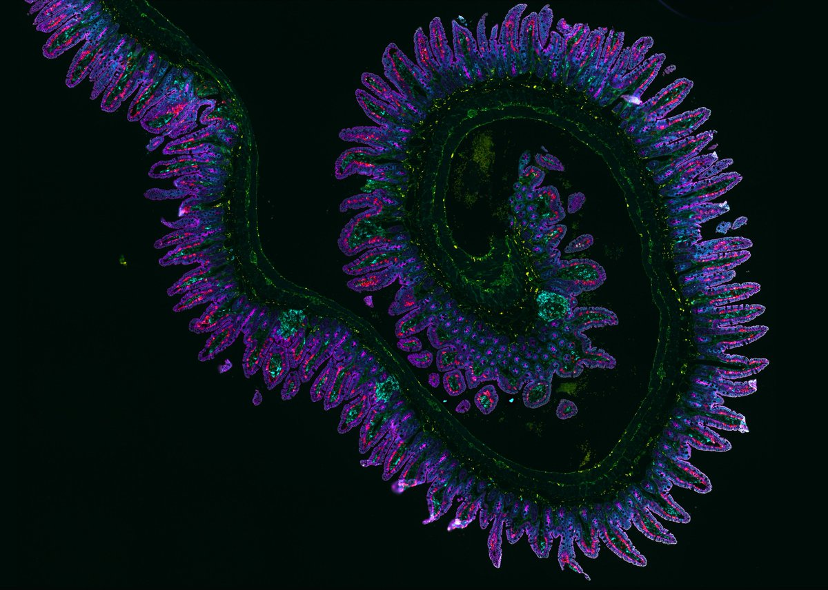 RareCyte, Inc. (@rarecyte) on Twitter photo We're thrilled to showcase this mouse ileum image, submitted by Simon Goldstein, <a href="/LJIMicroCore/">LJI Microscopy Core</a>, in our 2025 Calendar!
📸 Image Details: 15-channel imaging of a normal murine ileum spiral, acquired on the Orion Spatial Biology Platform.
#SpatialBiology #MultiplexImaging We're thrilled to showcase this mouse ileum image, submitted by Simon Goldstein, <a href="/LJIMicroCore/">LJI Microscopy Core</a>, in our 2025 Calendar!
📸 Image Details: 15-channel imaging of a normal murine ileum spiral, acquired on the Orion Spatial Biology Platform.
#SpatialBiology #MultiplexImaging
