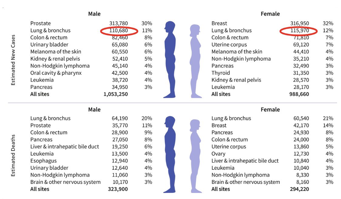 Cancer statistics- 2025
👀
Some 🫁 cancer observations:
1. Continued nice decrease in LC incidence/death rates
2. BUT probably 1st time in history of cancer stats- more cases in women than men
3. AND finally we no longer can say - “lung cancer causes more deaths than