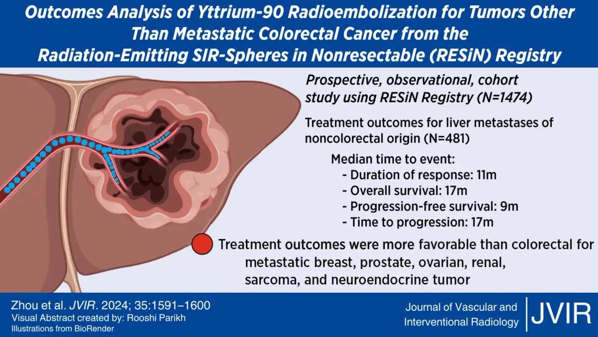 JVIR (@jvirmedia) on Twitter photo New visual abstract on outcomes of radioembolization for non-colorectal #cancer patients from the RESIN registry put together by <a href="/RooshiParikh/">Rooshi Parikh</a>
#IRad New visual abstract on outcomes of radioembolization for non-colorectal #cancer patients from the RESIN registry put together by <a href="/RooshiParikh/">Rooshi Parikh</a>
#IRad