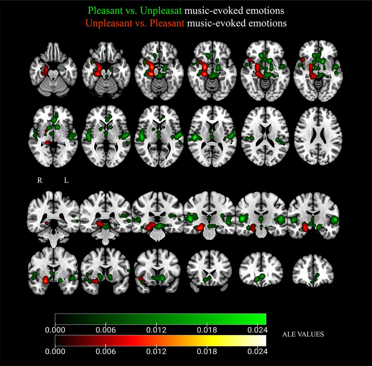 ImagingNeurosci's tweet photo. New paper in Imaging Neuroscience by Nieves Fuentes-Sánchez, Markus Junghöfer, et al

On joy and sorrow: Neuroimaging meta-analyses of music-induced emotion

https://t.co/0ehIeq1DLO https://t.co/NnEowoJkhy
