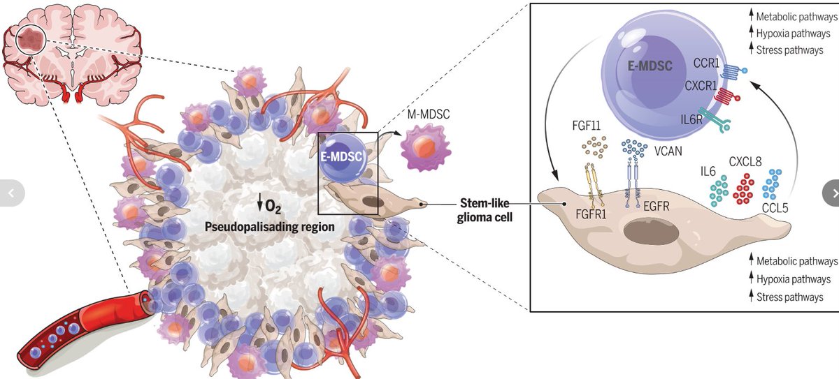 Distinct myeloid-derived suppressor cell populations in human glioblastoma
doi.org/10.1126/scienc…
<a href="/dpardol1/">Drew Pardoll</a> <a href="/ScienceMagazine/">Science Magazine</a>