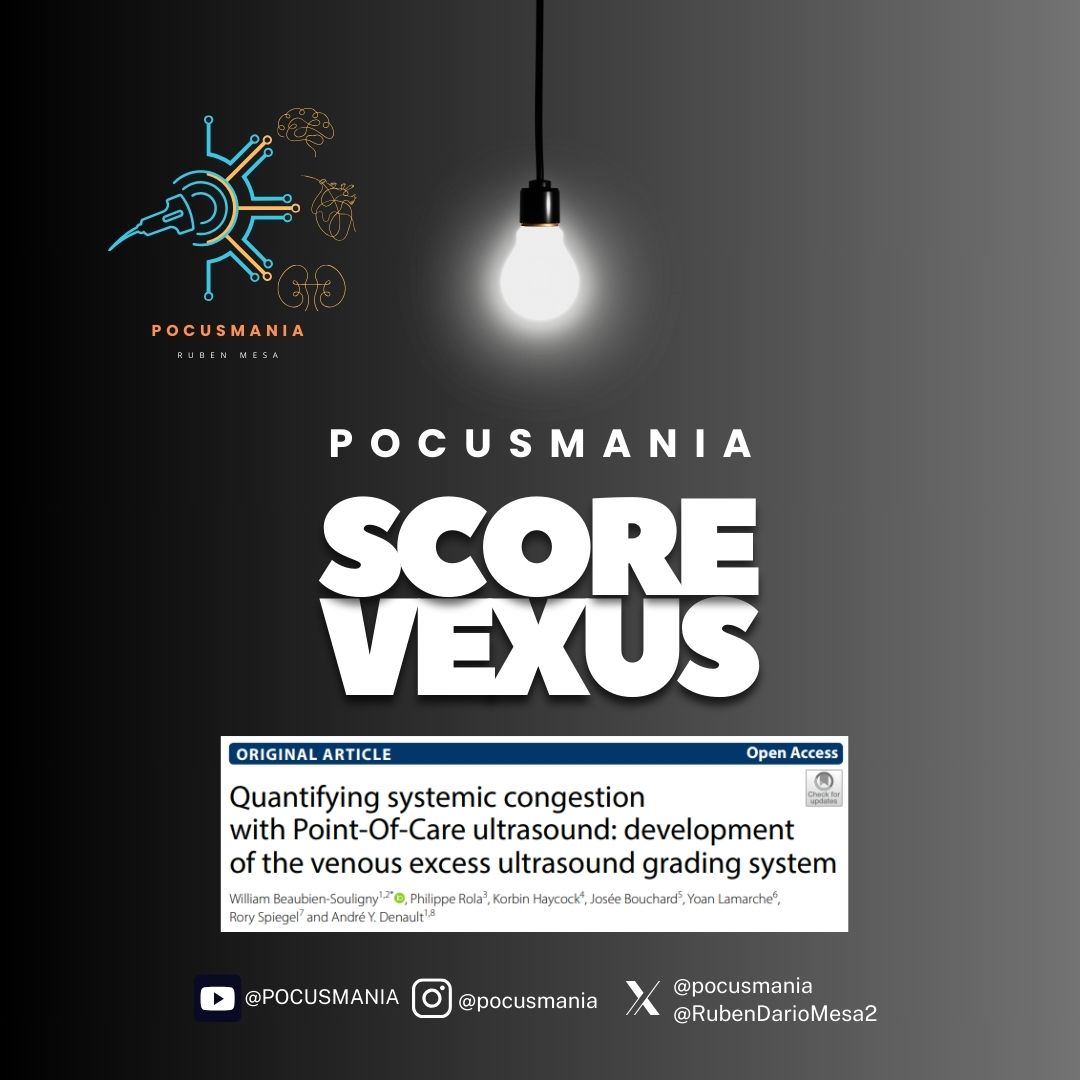 pocusmania's tweet photo. VExUS evalúa congestión venosa sistémica con ecografía Doppler en vena cava, hepática, portal y renal. Clasifica en leve, moderada y severa según flujo y patrones. Herramienta clave en pacientes críticos para manejo de fluidos. #Ultrasonido #VExUS #MedicinaCrítica #POCUS https://t.co/ERFzfrnrMM