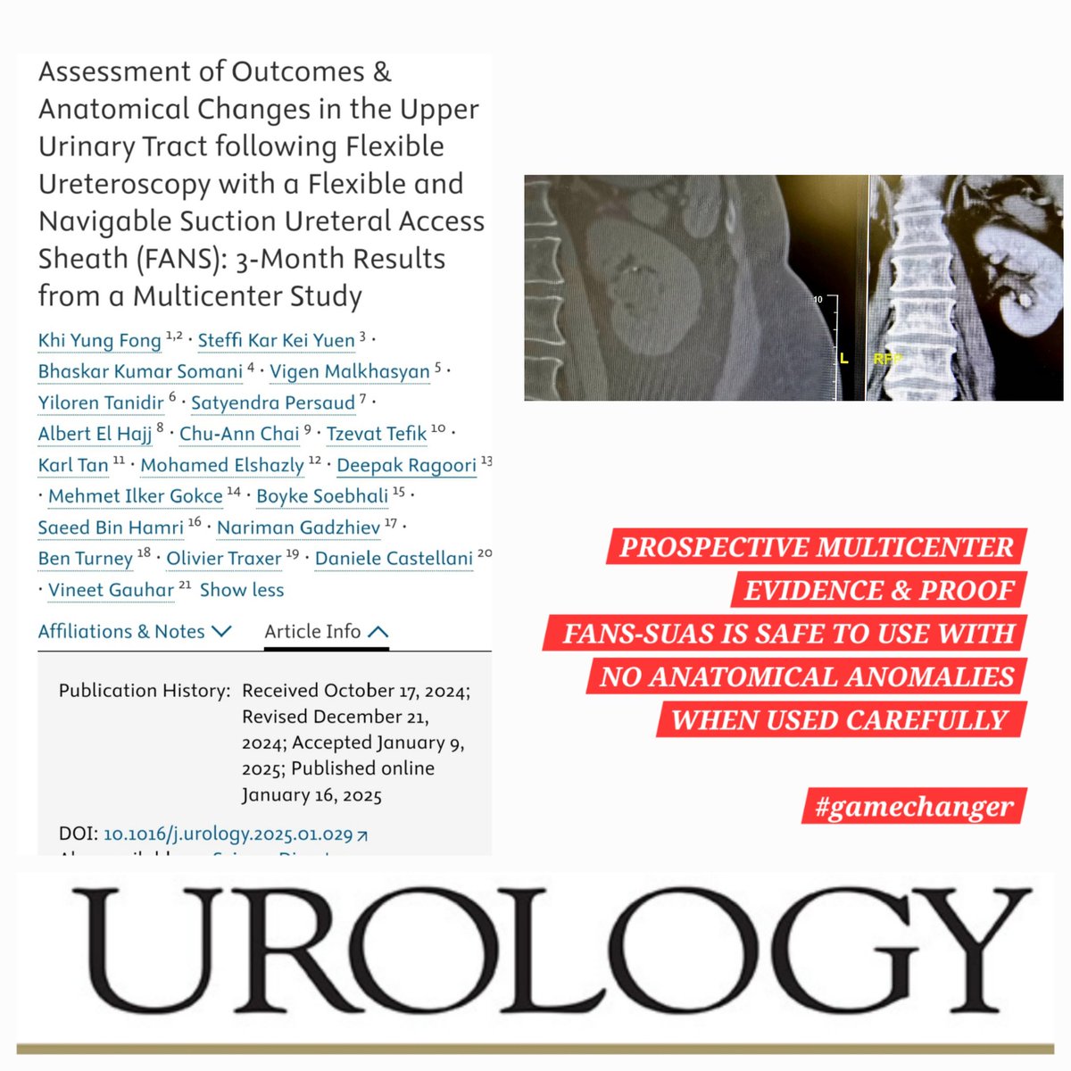 DrG (@docgauhar) on Twitter photo #2025Goals FANS IS SAFE
#UroSoMe
<a href="/urogoldjournal/">Urology Gold Journal</a> <a href="/steffiyuen/">Steffi Yuen</a>
<a href="/OTRAXER/">Olivier Traxer</a> <a href="/endouro/">Prof Bhaskar Somani</a> <a href="/bwturney/">Ben Turney</a> @<a href="/fongkhiyung/">Khi Yung</a> <a href="/CHAIcaMD/">CHAIcaMD</a> <a href="/ytanidir/">Yiloren Tanidir</a> <a href="/Urologeman/">Urologeman (Nariman Gadzhiev)</a> <a href="/PersaudDr/">Satyendra Persaud MBBS DM (Urol) FRCS FACS FFSTEd</a> <a href="/mohamed92902484/">mohamed elshazly</a> <a href="/soebhali/">Boyke Soebhali</a> <a href="/sbinhamrii/">Saeed Bin Hamri</a> <a href="/drvigen/">Vigen Malkhasyan</a> <a href="/tzevattefik/">Tzevat TEFIK</a> <a href="/iamdockarl/">Karl Tan, MD (Endouro) 🇵🇭</a> <a href="/migokce/">Mehmet Ilker Gökce</a> <a href="/drragoori/">𝘿𝙚𝙚𝙥𝙖𝙠 𝙍𝙖𝙜𝙤𝙤𝙧𝙞</a>
#fanofFANS <a href="/Uroweb/">European Association of Urology (EAU)</a> <a href="/D_Castellani/">Daniele Castellani</a> #2025Goals FANS IS SAFE
#UroSoMe
<a href="/urogoldjournal/">Urology Gold Journal</a> <a href="/steffiyuen/">Steffi Yuen</a>
<a href="/OTRAXER/">Olivier Traxer</a> <a href="/endouro/">Prof Bhaskar Somani</a> <a href="/bwturney/">Ben Turney</a> @<a href="/fongkhiyung/">Khi Yung</a> <a href="/CHAIcaMD/">CHAIcaMD</a> <a href="/ytanidir/">Yiloren Tanidir</a> <a href="/Urologeman/">Urologeman (Nariman Gadzhiev)</a> <a href="/PersaudDr/">Satyendra Persaud MBBS DM (Urol) FRCS FACS FFSTEd</a> <a href="/mohamed92902484/">mohamed elshazly</a> <a href="/soebhali/">Boyke Soebhali</a> <a href="/sbinhamrii/">Saeed Bin Hamri</a> <a href="/drvigen/">Vigen Malkhasyan</a> <a href="/tzevattefik/">Tzevat TEFIK</a> <a href="/iamdockarl/">Karl Tan, MD (Endouro) 🇵🇭</a> <a href="/migokce/">Mehmet Ilker Gökce</a> <a href="/drragoori/">𝘿𝙚𝙚𝙥𝙖𝙠 𝙍𝙖𝙜𝙤𝙤𝙧𝙞</a>
#fanofFANS <a href="/Uroweb/">European Association of Urology (EAU)</a> <a href="/D_Castellani/">Daniele Castellani</a>