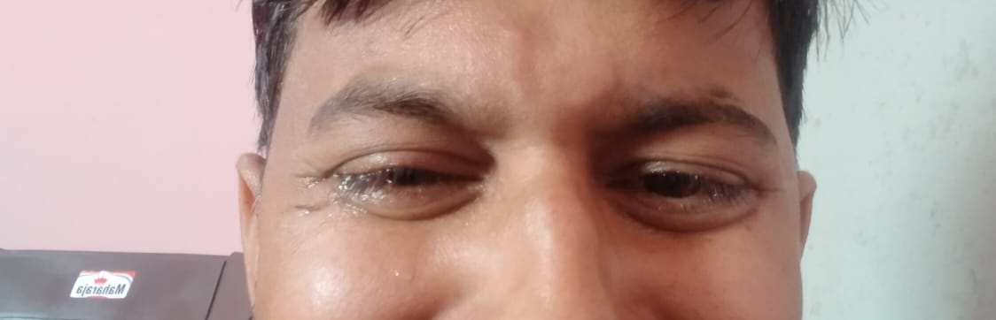 ये खून के आंसू रोने वाला कोई और नहीं, उत्तर प्रदेश का दलित पिछड़ा समाज है जिसे योगी  सरकार ने #69000_शिक्षक_भर्ती में घोटाला करके नौकरी से वंचित किया है और इनकी नौकरियां योगी जी ने अपने सवर्ण समाज के लोगों को दे दीं है। <a href="/myogiadityanath/">Yogi Adityanath</a> जी आपके अत्याचार व शोषण का अंत अवश्य होगा ।