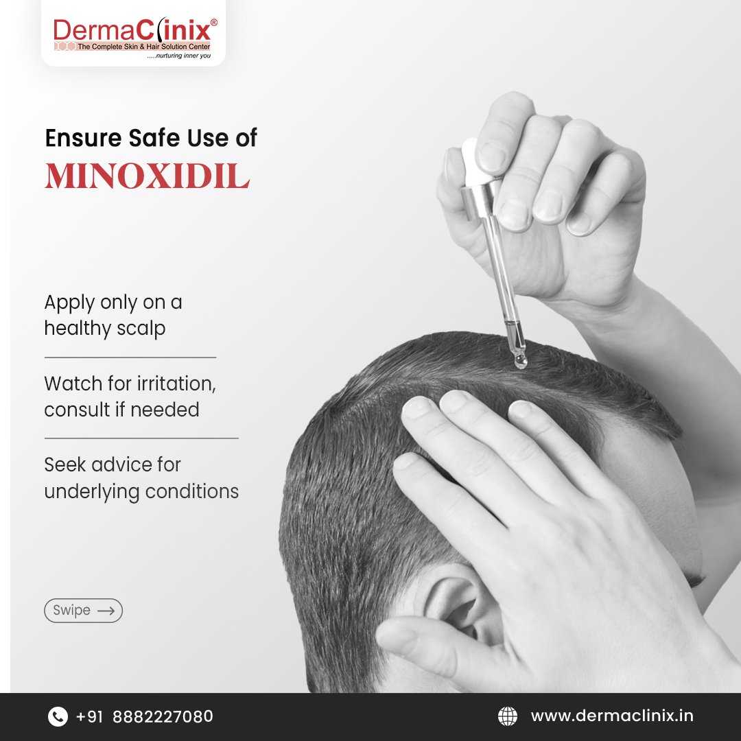 dr_kavish's tweet photo. Using Minoxidil for Hair Growth?

Do you know the right frequency of usage? 
Let us understand together.

Book your consultation today.

Call/WhatsApp us at +91 8882227080 for consultation

For more, visit: https://t.co/fE8Nj139nS

#HairCare #HairLoss #HealthyHair #BaldingJourney https://t.co/E4PZH5XORw