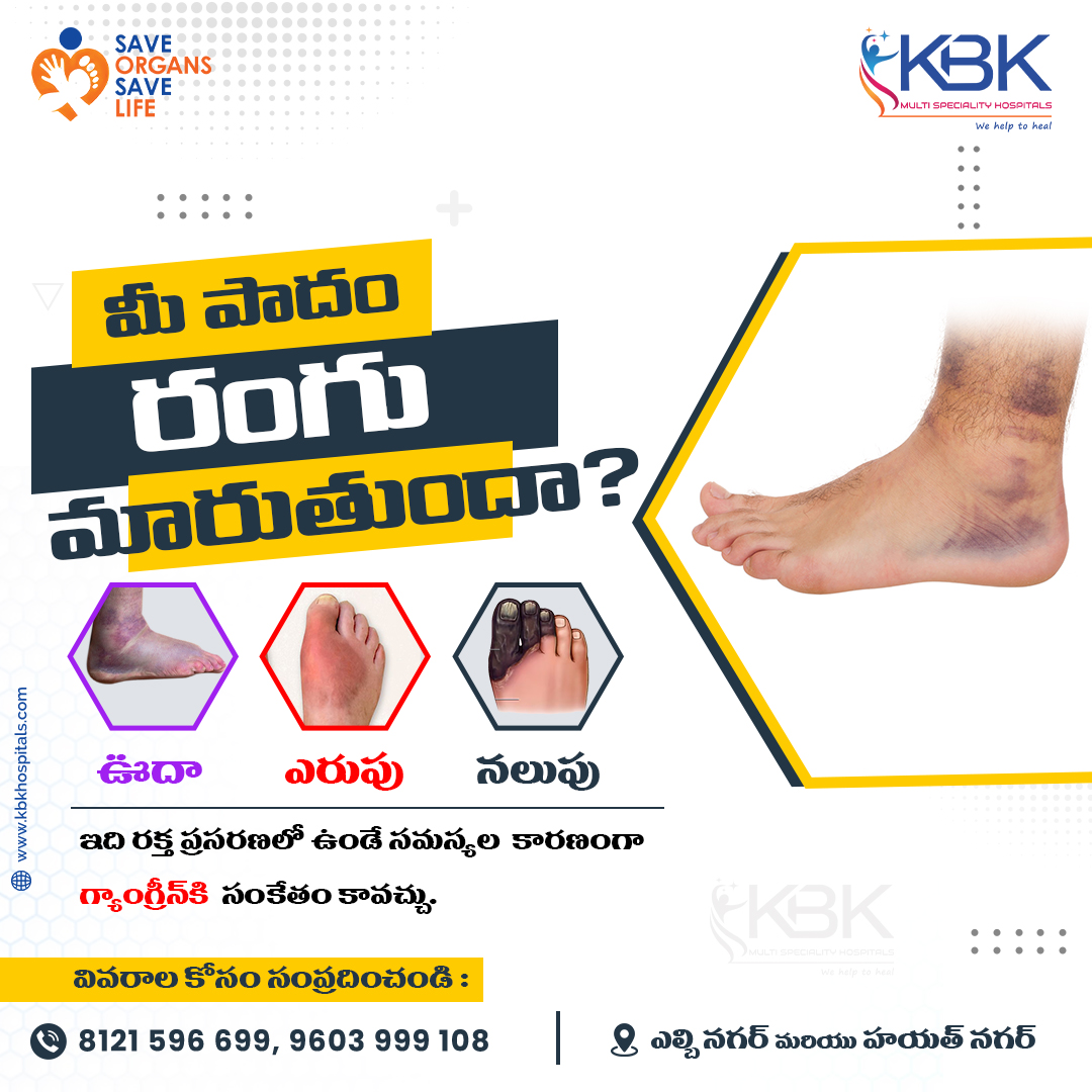 kbkhospitals's tweet photo. 🛑 Have you observed an unusual color change in your foot?
Don’t ignore it! It might be Gangrene. Immediate treatment can prevent severe outcomes.
#gangrenetreatment #bharathkakkireni #withoutamputation #saveorganssavelife #kbkhospitals #kbkgroup https://t.co/fKgjU13Q3w