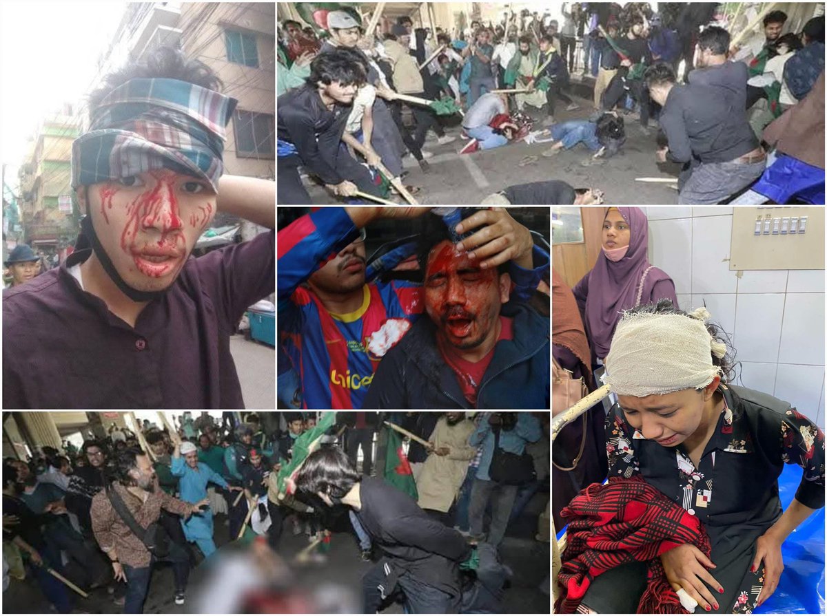 bdwatch2024's tweet photo. How safe is "new #Bangladesh" for #minorities? At least 20 persons were injured in an attack during protests against the removal of the word "indigenous" from textbooks. The next day, when protesting the earlier attack, they got attacked again! This time by #police.

At least 20 persons were injured on Wednesday in an attack on an indigenous group and its supporters protesting the removal of the word "indigenous" (adivasi, in Bangla) from books. Although the attack was officially carried out by a group called "#Students for Sovereignty", links of people present on the scene with Islami Chhatra Shibir (Jamaat E Islami's student wing) and Jatiyo Nagorik Committee (SAD's so-called civil-society off-shoot) have been reported in press and social media. 

News🔽

https://t.co/OXOBWAV23I

The next day, when a demo was taking place to protest the violent attack the day earlier, the police attacked, using water cannons and stun grenades. Baton charges scattered the protesters. 7 more protesters were injured. 

News🔽
https://t.co/quN94mPTML

In summary, when it comes to treatment of indigenous populations, the majoritarian radicals and the police are operating on the same wavelength.
 
#BangladeshCrisis @amnesty @hrw @amnestysasia @HRF @AFP @AP @reutersasia @Chellaney @Kai_Schultz @CharlieCamp6ell @JonathanEmont @MujMash @JohnReedwrites @HannahEP @CJBdingo25 @paulocasaca1 @UNHumanRights @volker_turk @UN4Indigenous @StateDRL @RFKHumanRights @FCDOGovUK @eu_eeas @HumanRightsCtte @EURightsAgency @BBCWorld @UtsavSanduja @_pallavighosh @dwnews @Sabir59 @johnstanly