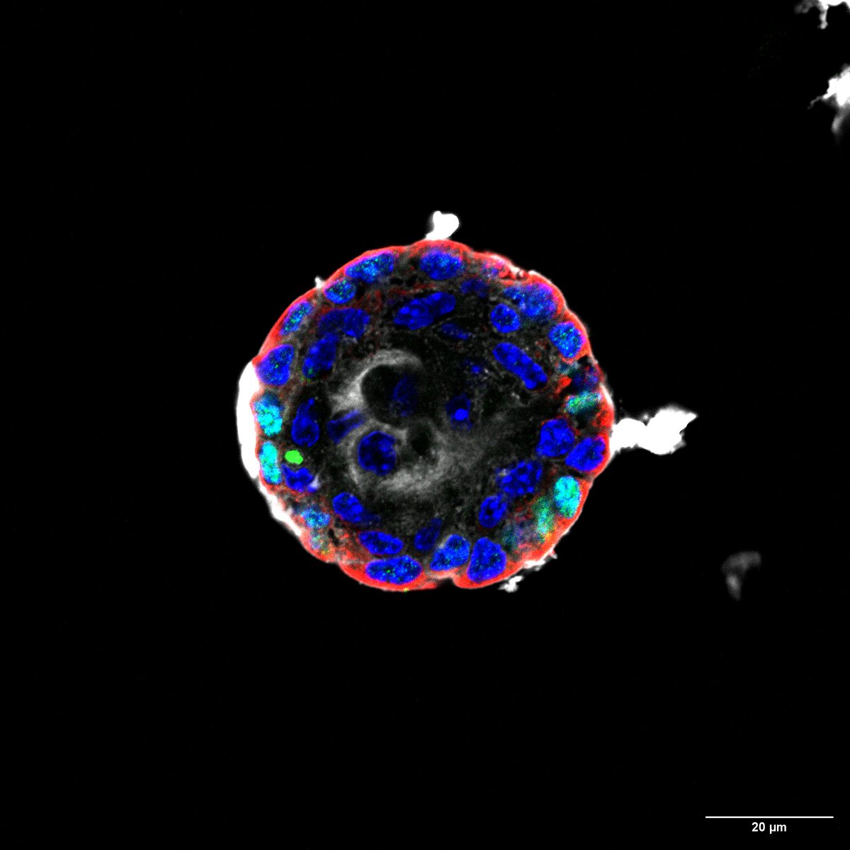 London Stem Cell Network (@lscn_uk) on Twitter photo 📢New workshop announcement!
Join us on 05/02 at <a href="/QMUL/">Queen Mary University of London</a> to discuss the latest updates on #organoids from great scientists and our sponsors <a href="/QkineBio/">Qkine</a>, <a href="/ams_bio/">AMSBIO</a> and <a href="/biotechne/">Bio-Techne</a>.
Become a member of LSCN and register for free!
eventbrite.co.uk/e/organoids-in…
lscn.co.uk 📢New workshop announcement!
Join us on 05/02 at <a href="/QMUL/">Queen Mary University of London</a> to discuss the latest updates on #organoids from great scientists and our sponsors <a href="/QkineBio/">Qkine</a>, <a href="/ams_bio/">AMSBIO</a> and <a href="/biotechne/">Bio-Techne</a>.
Become a member of LSCN and register for free!
eventbrite.co.uk/e/organoids-in…
lscn.co.uk