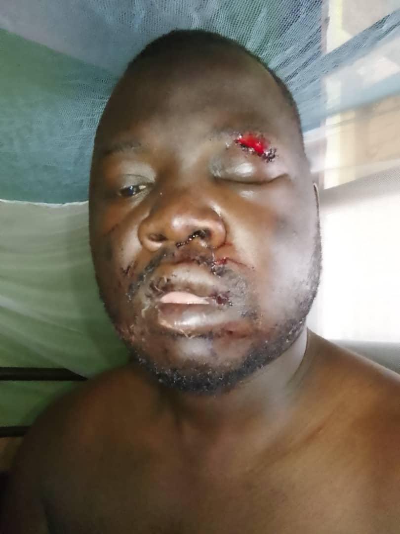 GByaruhanga01's tweet photo. Eloi #Kambale was beaten to a pulp by #Tshisekedi's death merchants after he publicly exposed the regime's failures and opposed the tyrant's selfish agenda to change the national constitution.

@PatrickMuyaya @RDCongoMAE @MartinFayulu @moise_katumbi @DSESANGA @Presidence_RDC https://t.co/nAzg7KWgmn