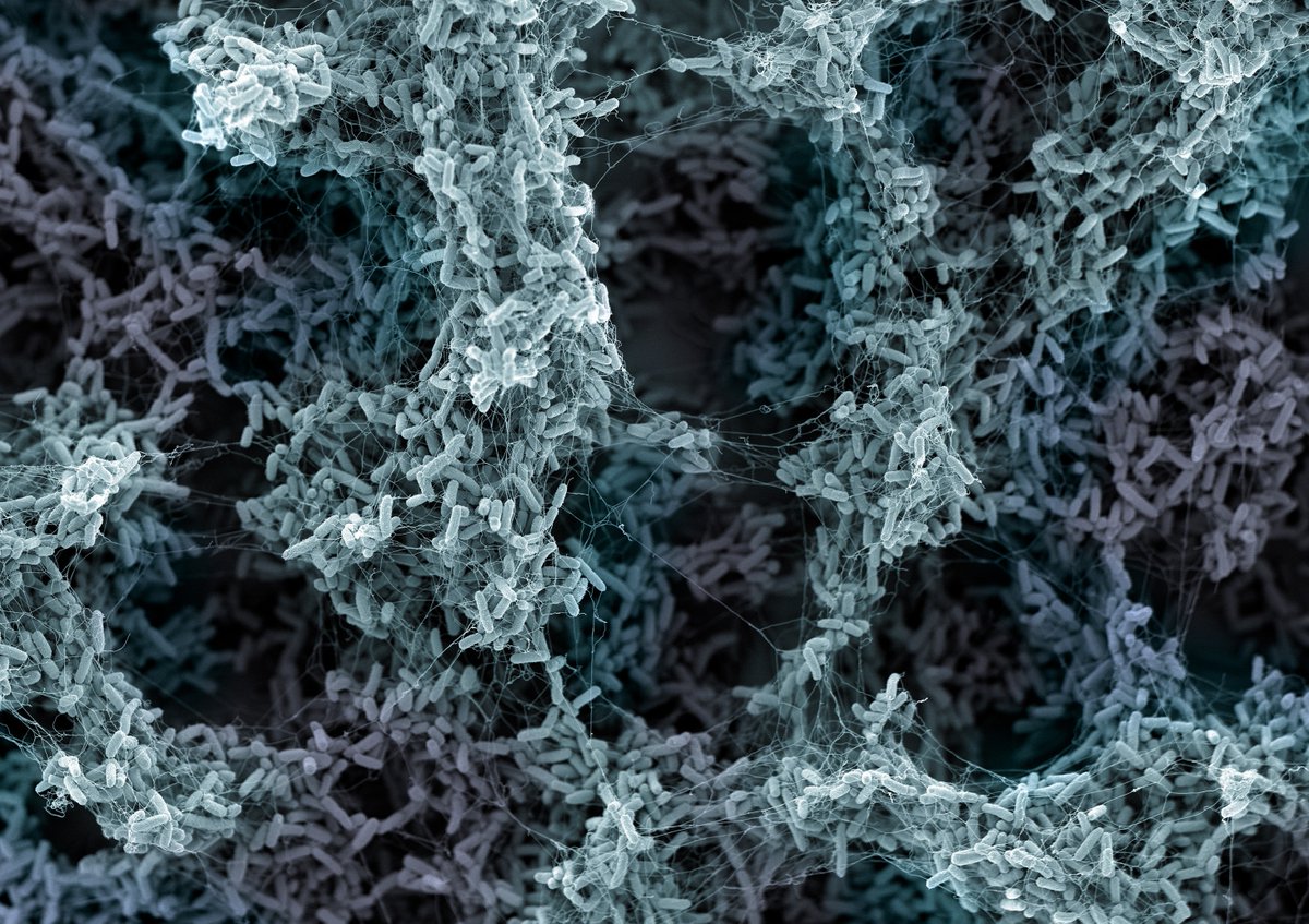 BIOspektrum (@spektrum_bio) on Twitter photo In ihrer Arbeit haben Forschende um <a href="/knutdrescher/">Knut Drescher</a> <a href="/UniBasel/">Universität Basel</a> herausgefunden, dass Bruchstücke der Bakterien-Zellwand, die Peptidoglykane, die Bakterien auf Gefahren in der Umgebung hinweisen.
nature.com/articles/s4156…
Bild: Nano Imaging Lab SNI/Biozentrum, Universität Basel In ihrer Arbeit haben Forschende um <a href="/knutdrescher/">Knut Drescher</a> <a href="/UniBasel/">Universität Basel</a> herausgefunden, dass Bruchstücke der Bakterien-Zellwand, die Peptidoglykane, die Bakterien auf Gefahren in der Umgebung hinweisen.
nature.com/articles/s4156…
Bild: Nano Imaging Lab SNI/Biozentrum, Universität Basel