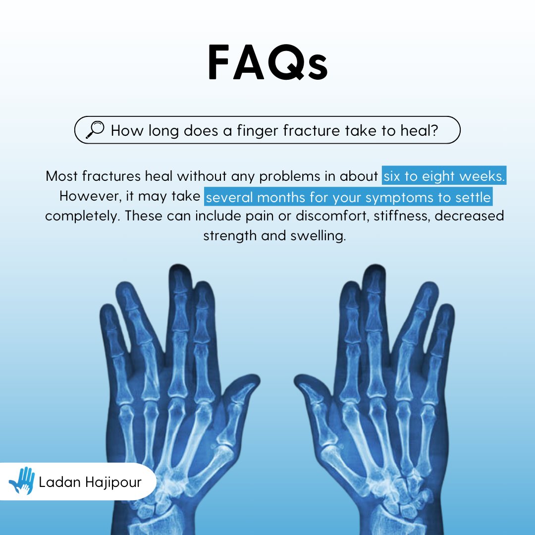 The finger is made up of bones known as phalanges, with three of these in each finger and two in each thumb. A finger fracture is when one or more of these bones breaks.🖐🦴

If you suspect a finger fracture, get in touch 👉 ladanhajipour.com/book-appointme…

#FingerFracture