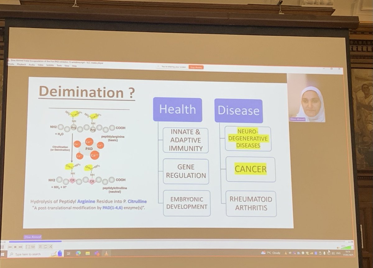 PADs_CNS's tweet photo. Great to hear Dina Ahmed ⁦@CNSRegeneration⁩ presenting some of her PhD research on #Citrullination in #CNS injury and #regeneration at our ⁦@LifeSciWestmin⁩ PhD conference today 🎉🔬 https://t.co/kDEm7wnUj3