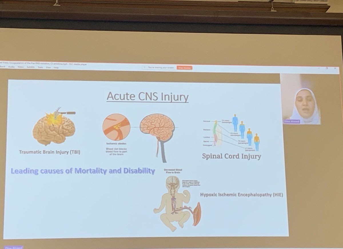 Prof. Sigrun Lange, FRSB, FLS (@pads_cns) on Twitter photo Great to hear Dina Ahmed <a href="/CNSRegeneration/">D🧬NA Ahmed Khaled</a> presenting some of her PhD research on #Citrullination in #CNS injury and #regeneration at our <a href="/LifeSciWestmin/">School of Life Sciences, University of Westminster</a> PhD conference today 🎉🔬 Great to hear Dina Ahmed <a href="/CNSRegeneration/">D🧬NA Ahmed Khaled</a> presenting some of her PhD research on #Citrullination in #CNS injury and #regeneration at our <a href="/LifeSciWestmin/">School of Life Sciences, University of Westminster</a> PhD conference today 🎉🔬