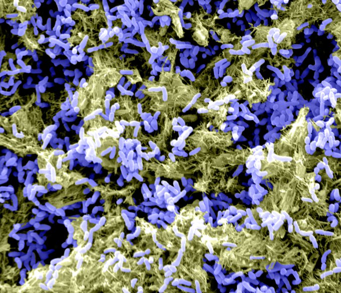 National Biofilms Innovation Centre (NBIC) (@ukbiofilms) on Twitter photo 📢<a href="/unisouthampton/">University of Southampton</a> <a href="/sotonbiosci/">Biological Sciences</a> are seeking an Associate Professor or #Professor with experience in the #biology and mechanisms of microbial #biofilms to contribute to enhancing NBIC’s reputation as a pioneering centre for #biofilm research & #innovation
➡️tinyurl.com/mr756rap 📢<a href="/unisouthampton/">University of Southampton</a> <a href="/sotonbiosci/">Biological Sciences</a> are seeking an Associate Professor or #Professor with experience in the #biology and mechanisms of microbial #biofilms to contribute to enhancing NBIC’s reputation as a pioneering centre for #biofilm research & #innovation
➡️tinyurl.com/mr756rap